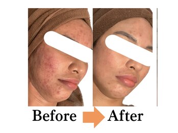 アランルージュ(ALANROUGE)/劇的★ビフォーアフター