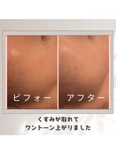 ワイズ(Y's)/水素導入