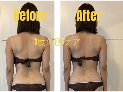 アネラ(Anela)の写真