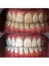 ワールドビューティー(World Beauty)/