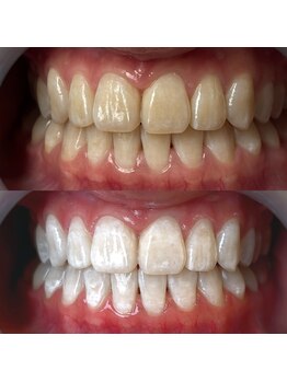 ワールドビューティー(World Beauty)/