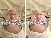 マヴィ 守口店(MavY.)/もちっと肌へ！