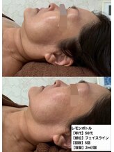 アオダモ(aodamo)/