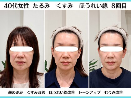 美容整体 ソワンの写真