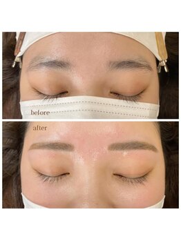 エムアンド(m&)/ワックス脱毛1回