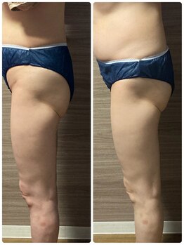 ナナ整骨鍼灸院 ココ(Nana整骨鍼灸院 Coco)/メンズ痩身