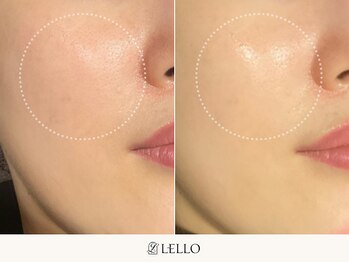 レロ 恵比寿店(LELLO)/