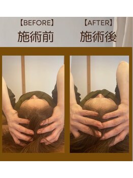 アイヲン(Aiwon)/【頭痛】ビフォーアフター