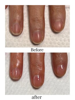 トイロ ネイル(Toiro Nail)/◇HAND◇クイックケア初日