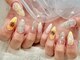 ミラクルネイル(Miracle Nail)の写真/【技術力で仕上がりの満足度◎】高技術×個性の魅力を引き出す!周りにも自慢したくなるような指先へ。