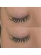 バニーアイズ 天神(Bunny eyes TENJIN)/フラット140本