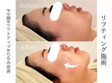 エン クリニカルラボ 心斎橋店(E&N CLINICAL LABO)の雰囲気(韓国人Vライン作り!小顔リフト/たるみほうれい線/二重顎)