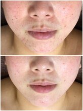 クレビア(CREBIA)/