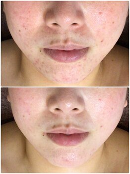 クレビア(CREBIA)/