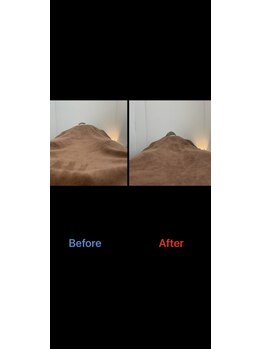 ブライトプラス(BRIGHT+)/大口式骨盤整体ビフォーアフター