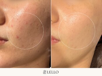 レロ 恵比寿店(LELLO)/