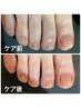 フットネイルケア+足裏角質ケア¥8,500→¥7,500