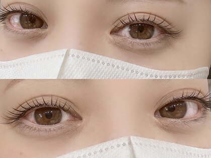 ジューシーアイ 成増店(Juicy Eye)の写真