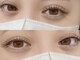 ジューシーアイ 成増店(Juicy Eye)の写真