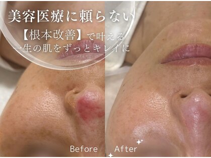 クリエ(Clie)の写真