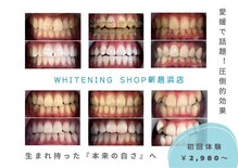 ホワイトニングショップ 新居浜店