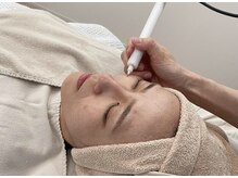 当店自慢のシミケア。ピンポイントでシミに集中アプローチ！