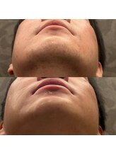 フェリーバ(FELIVA)/ツルピカお肌♪