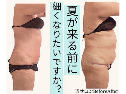 ナナイロ(nanairo)の写真