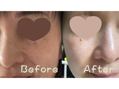 メナード 大通公園の写真