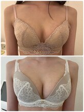 美人バスト 浦和店/【バストアップ★育乳】症例