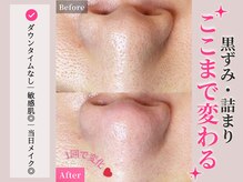 エミール