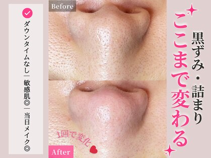 エミールの写真