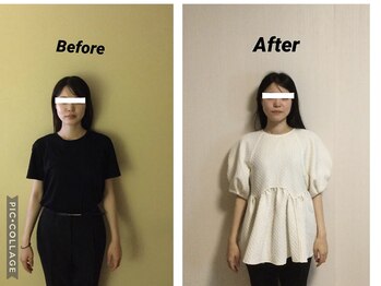 ショウフェイスデザイン(Sho Face Design)/《全身整体》ビフォーアフター