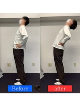 ナオル整体 神戸住吉院(NAORU整体)/20代男性【腰痛】