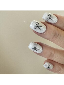 イオネイル(io nail)の写真/巻き爪/反り爪/乾燥/ジェルが浮きやすい等トラブルケアが得意なionailで乾燥する冬のネイルはお任せ下さい!