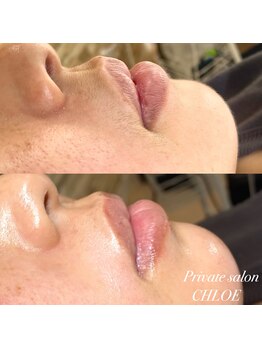 クロエ(CHLOE)/美肌フェイスワックス