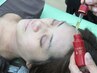 ＼スタンダード短期間集中／幹細胞美容鍼＋デコルテヘッド＋セルキュア4t＋