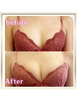 ジュエルリング(Jewel Ring)/バストアップ【恵比寿代官山】