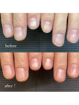 ル ソレイユ(Le soleil)/メンズネイルケア!beforeafter