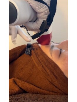 ルアナ アイナ(luana aina)/顔脱毛