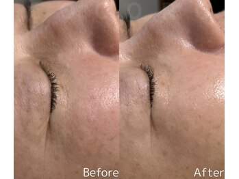 ココロ(COCORO)/大人気エイジングケア♪