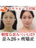 人気No.1◎¥15,400〈通常¥55,000〉歪み小顔矯正26ヶ所＋骨盤矯正　75分