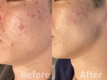 肌レボ 高田馬場店(肌REVO)