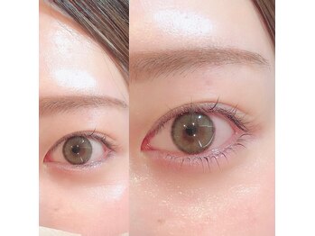 ゴコチ(5cochi)/下まつ毛の逆さまつげ改善パーマ