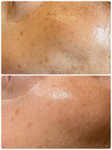 リヤン(Lien)/気になるシミのケアにも◎