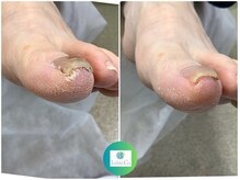 カリテス 富ヶ谷店(charites)/ ネイルキュアコース