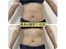 アーチ(AR-CH.)/ウエスト