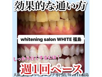 ホワイトニングサロン ホワイト(WHITE)/セルフホワイトニング/大阪/福島