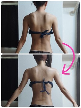痩身と癒しのリンパサロン コッコ(Cocco)/肩甲骨が正しい位置に( *´艸｀)
