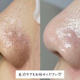 ベリッシマ(Bellissima)